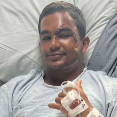 Kala Grace sale de la UCI: “Mahalo por el amor y el apoyo”