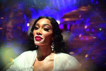 Winnie Harlow. 