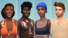 The Sims 4 adds vitiligo skin via a free update