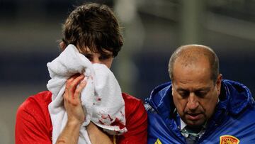 Yeray Álvarez, tras recibir el codazo de Chiesa.