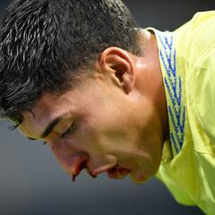 Alejandro Zendejas entrena con máscara protectora