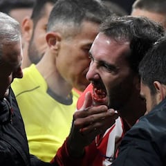 Godín se fracturó tres dientes en el choque con Neto