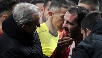 Godín, con los dientes rotos tras el golpe de Neto.