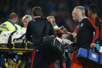 Las imágenes de la fractura de tibia de Luke Shaw