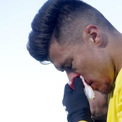 Juanjo Narváez se quedó anoche en Madrid con la nariz rota