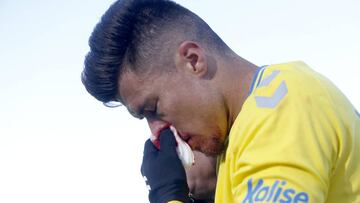 Juanjo Narváez se quedó anoche en Madrid con la nariz rota