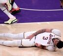 Anthony Davis a doubt for Lakers-Suns Game 5