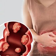 Los síntomas que alertan del cáncer de páncreas