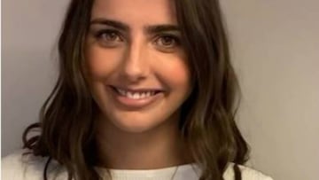 Por una difícil enfermedad Michelle Renaud se quita los implantes de seno