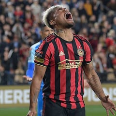 ¡El regreso del Rey! Josef Martínez muestra la evolución de su lesión