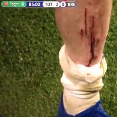 Quería saltar al campo con la pierna así y apareció Mourinho