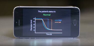 La app PupilScreen comprueba si hay daños cerebrales después de un golpe