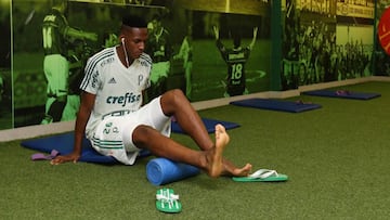 Los pies de Yerry Mina necesitan trato especial