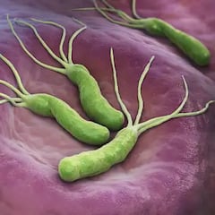 La OMS alerta de una bacteria que afecta a la mitad de los españoles: puede provocar cáncer de estómago