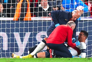 Bloody nose | Portugal's Cristiano Ronaldo receives medical attention against Czech Republic.