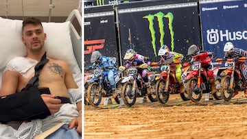 Tim Gajser se opera del hombro y es baja indefinida en el Mundial de MXGP.