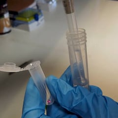 La metilprednisolona disminuye la mortalidad por coronavirus