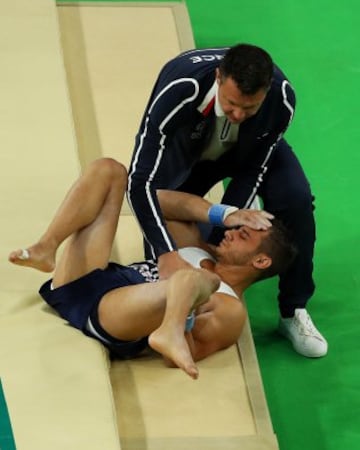 El gimnasta francés se fracturó la tibia de su pierna izquierda tras un mal salto. Sus compañeros no lo pedían creer. La peor imagen de Río 2016.