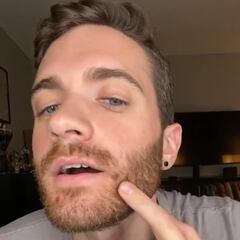 El actor Matt Ford se contagia de la viruela del mono: “Solo dormía con analgésicos”