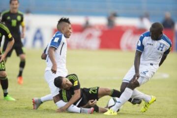 El mediocampista hondureño sufrió una impactante lesión, luego de que Javier Aquino le cayó encima de la pierna en una jugada sin intención en el duelo de Concacaf.



