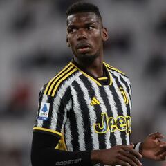Pogba, rumbo a más de 400 días lesionado
