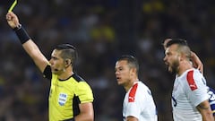 Dolencias del DIM: alteraciones en el sueño y ansiedad