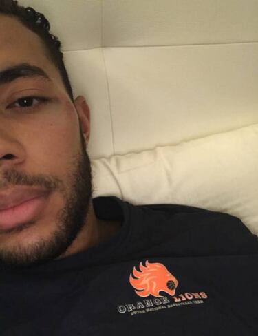 Así le dejó la cara Gallinari a Jito Kok: "Se llevó la peor parte"