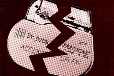 Casi medio millón de marcapasos corren peligro de ser hackeados