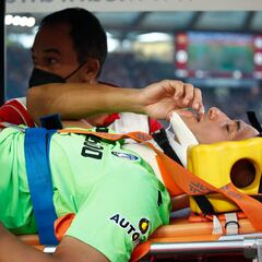 Musso podría perderse el Mundial