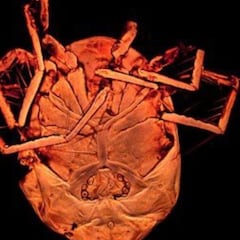 Descubierto un nuevo tipo de ácaro en una charca de Alpedrete