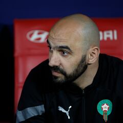 “¿Por qué Mbappé no juega con Camerún o Argelia?”