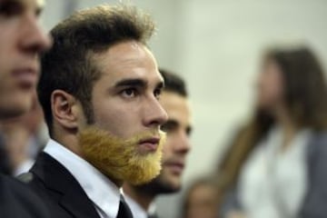 Carvajal con la barba teñida