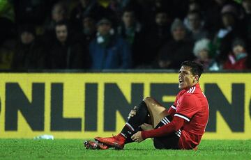 Manchester United's Chilean striker Alexis Sanchez holds his ankle after a tackle during the FA Cup fourth round football match between Yeovil Town and Manchester United at Huish Park in Yeovil, Somerset on January 26, 2018. / AFP PHOTO / - / RESTRICTED TO EDITORIAL USE. No use with unauthorized audio, video, data, fixture lists, club/league logos or 'live' services. Online in-match use limited to 75 images, no video emulation. No use in betting, games or single club/league/player publications.  / 