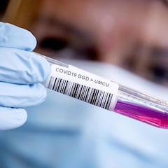 Wuhan: 300 casos asintomáticos tras casi 10 millones de test