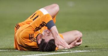 Markel Bergara, de forma accidental, clava un taco a Bale en su rodilla derecha.