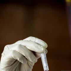 Coronavirus Colombia: ¿Qué es el Interferón, la proteína que están usando en Nariño?