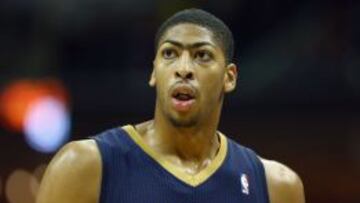 Anthony Davis.