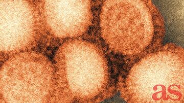 Why 'Spanish Flu' got its name