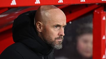 Manchester United's Dutch manager Erik ten Hag reacts ahead of the English FA Cup fifth round football match between Nottingham Forest and Manchester United at The City Ground, in Nottingham, central England, on February 28, 2024. (Photo by Oli SCARFF / AFP) / RESTRICTED TO EDITORIAL USE. No use with unauthorized audio, video, data, fixture lists, club/league logos or 'live' services. Online in-match use limited to 120 images. An additional 40 images may be used in extra time. No video emulation. Social media in-match use limited to 120 images. An additional 40 images may be used in extra time. No use in betting publications, games or single club/league/player publications. / 