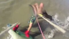 Gustavo Cervi&ntilde;o, kitesurfista, recibe el ataque de un pitbull en la playa de San Clemente de Tuy&uacute;, Argentina.