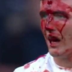 Escalofriante brecha en la frente de un jugador en el Seis Naciones