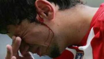 <b>CONMOCIONADO.</B> Así acabó el serbio en el segundo amistoso disputado por los rojiblancos por tierras inglesas.