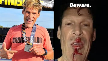 Dean Karnazes sufre el ataque de un coyote en plena carrera