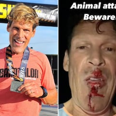 Dean Karnazes sufre el ataque de un coyote en plena carrera