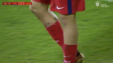 As赤 qued車 la pierna de Diego Costa tras la jugada del gol