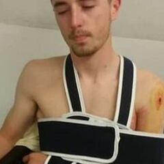 Un joven ciclista francés, herido de bala mientras se entrenaba