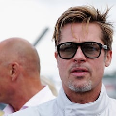 El resultado de gastar 17.000 euros para ser como Brad Pitt