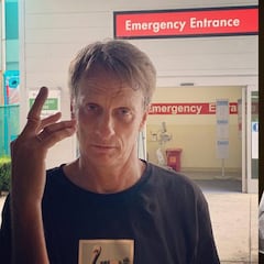 La lesión de Tony Hawk en los dedos que pone los pelos de punta