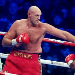Tyson Fury visitará el quirófano tras vencer a Dereck Chisora