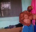 Así quedó el Hulk de Brasil al inyectarse aceite en el bíceps